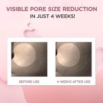 آمپول کوچک کننده منافذ سنتلا SKIN1004 Poremizing
