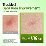 سرم تسکین دهنده قرمزی صورت آزلائیک اسید ۱۰٪ و هیالورون آنوا | Anua Azelaic Acid 10 Hyaluron - Image 5