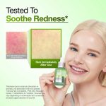 سرم تسکین دهنده قرمزی صورت آزلائیک اسید ۱۰٪ و هیالورون آنوا | Anua Azelaic Acid 10 Hyaluron - Image 4
