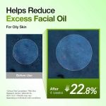 سرم تسکین دهنده قرمزی صورت آزلائیک اسید ۱۰٪ و هیالورون آنوا | Anua Azelaic Acid 10 Hyaluron - Image 3