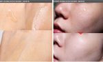 اسنس آبرسان هیالورونیک اسید کوزارکس 100 میل - تصویر 2